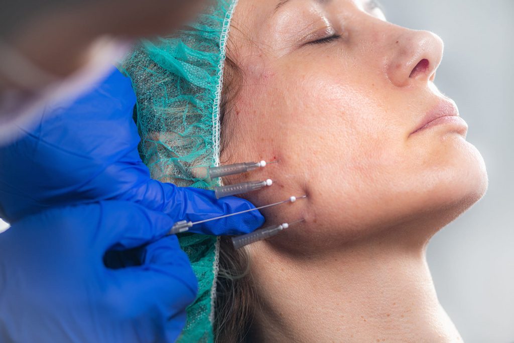 close-up-of-cosmetic-procedure-on-woman-s-face-2026-09-21-01-58-08-utc.jpg