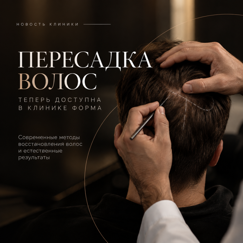 Новый клинический профиль в “Форме”: трансплантация волос